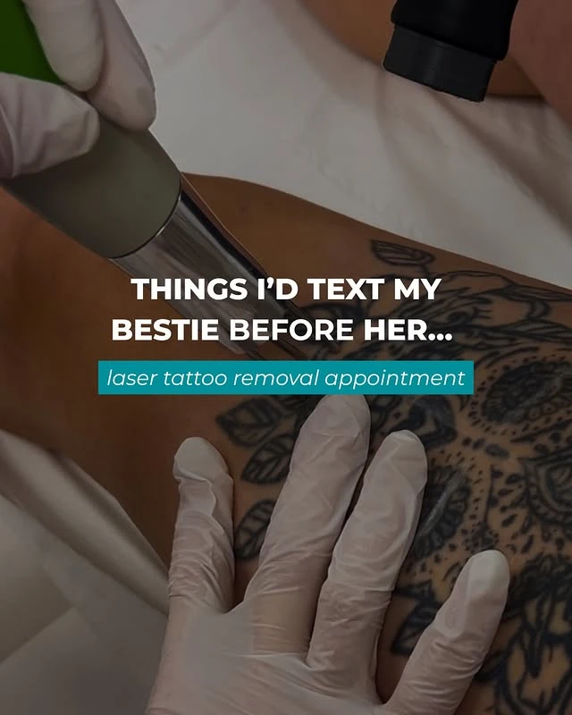 Black tattoo removal before and after photo